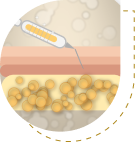 How it works image 1