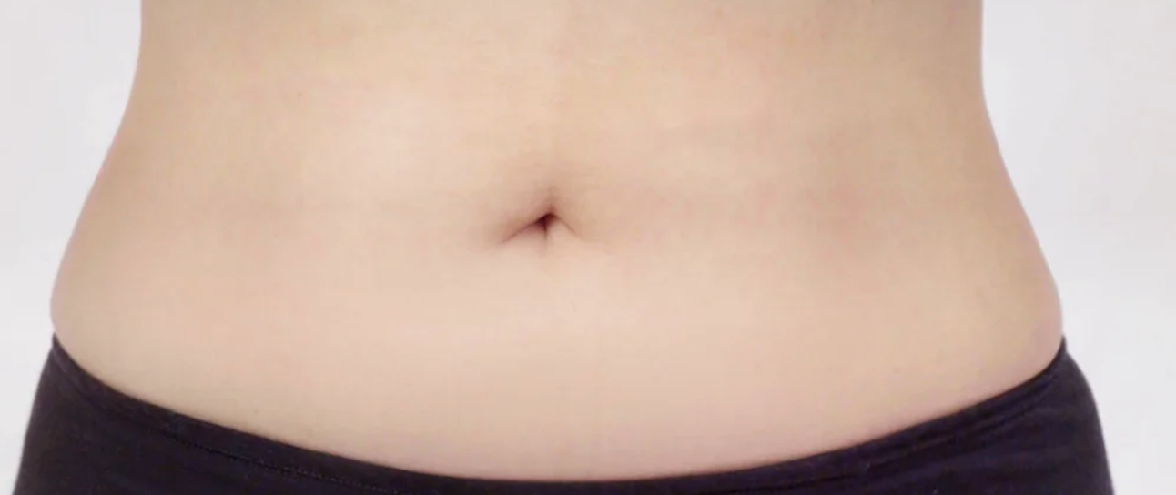 After procedure image